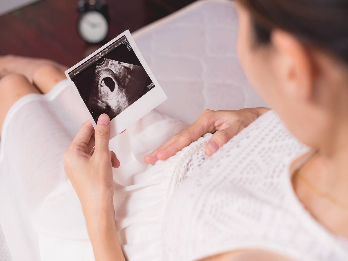УЗИ беременной женщины на первом месяце